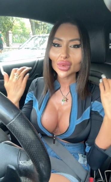 Та самая женщина с самыми большими скулами: Как она выглядела до преображения?