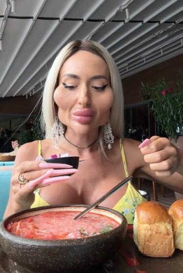 Та самая женщина с самыми большими скулами: Как она выглядела до преображения?