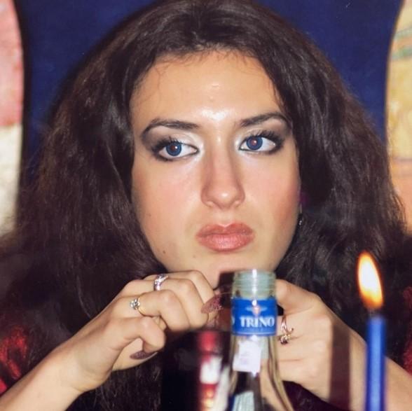 Та самая женщина с самыми большими скулами: Как она выглядела до преображения?
