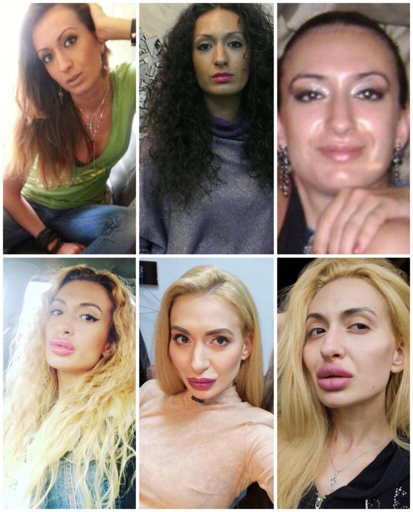 Та самая женщина с самыми большими скулами: Как она выглядела до преображения?