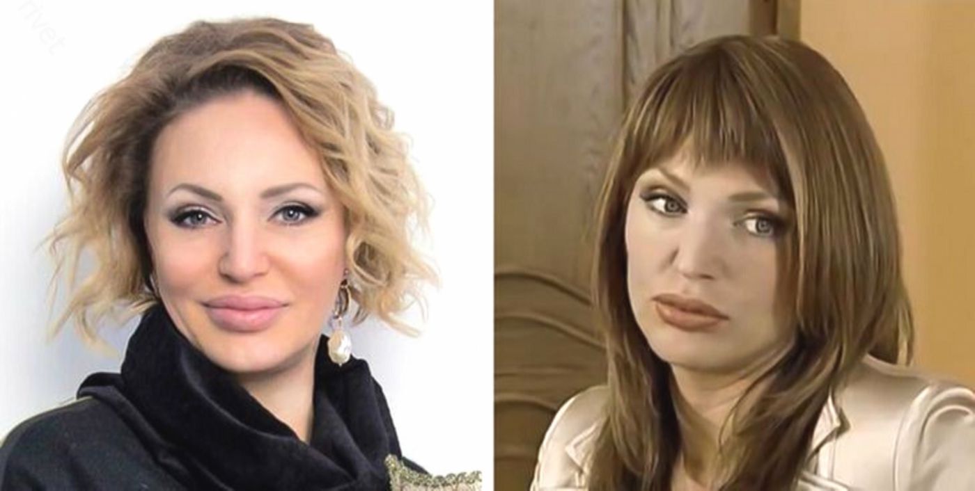 Родная мать не узнает: 11 звёзд, которые после пластики стали совсем другими