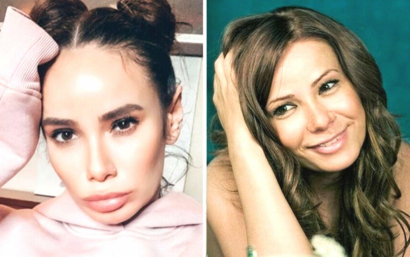 Родная мать не узнает: 11 звёзд, которые после пластики стали совсем другими